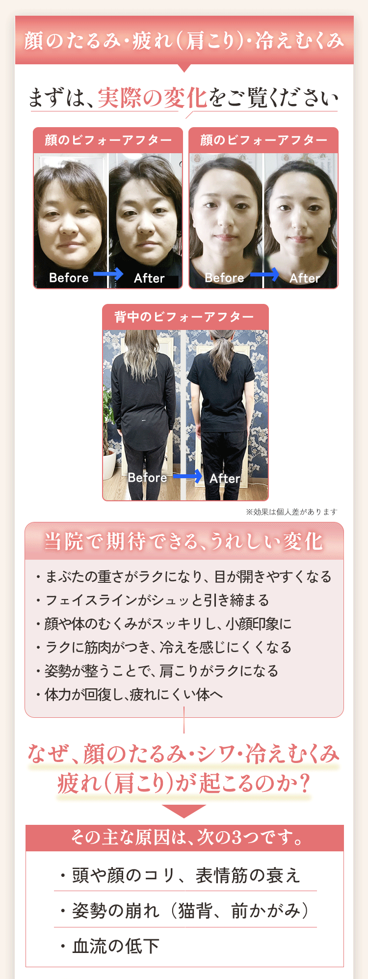 顔のたるみ・疲れ（肩こり）・冷えむくみ